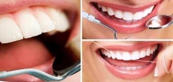 Diş Eti Çekilmesi Neden Olur? Nasıl Tedavi Edilir?