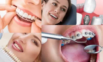 Dental Tedavilerde Kusursuz Hizmet