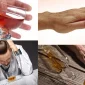 Alkol Bağımlılığı Nedir?
