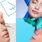 Türkiye'de Rinoplasti - Rhinoplasty in Turkey Fiyatları Ne Kadar?