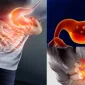 Gastrit Nedir? Belirtileri ve Tedavisi Nasıl Olmalıdır?