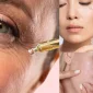 Retinolun Ciltteki Etkisi: Cilt Yenilenmesinde Rolü